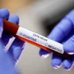 Instrukcija Islamske zajednice za postupanje u slučajevima širenja koronavirusa