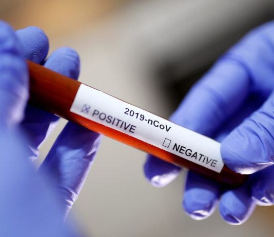 Instrukcija Islamske zajednice za postupanje u slučajevima širenja koronavirusa