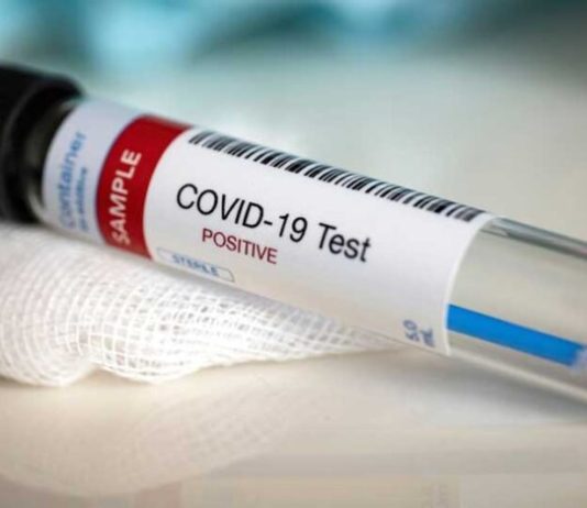 Novi Pazar: Testirano još 28, pozitivan jedan