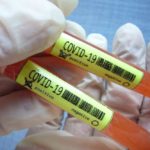 Novi Pazar: Još dvije osobe pozitivne na korona virus, ukupno 40