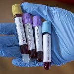 ZZJZ Novi Pazar: Nema razloga za paniku, od početka epidemije ukupno 171 zaraženi