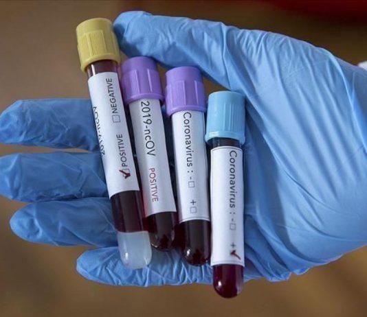 ZZJZ Novi Pazar: Nema razloga za paniku, od početka epidemije ukupno 171 zaraženi