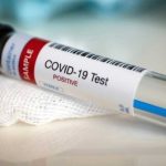 Još jedna žrtva korone: Preminuo muškarac iz Sjenice