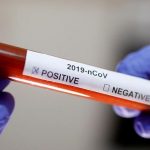 Novi Pazar: Bez umrlih od posljedica korona virusa, u bolnici ispod 100 pacijenata