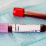 Uspješna primena krvne plazme, svaki donor znači