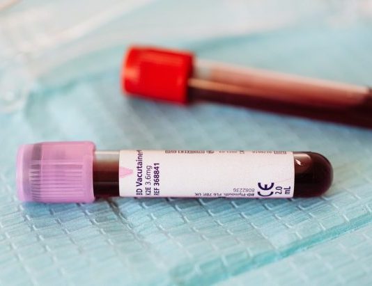 Uspješna primena krvne plazme, svaki donor znači