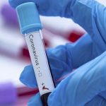 Još 32 zaražena u Novom Pazaru