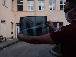 Jedan novi prijem u crvenu Covid zonu