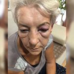 U Novom Pazaru pretučena žena, penzionisani major policije