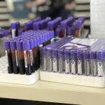 Slab odaziv dobrovoljnih davalaca krvi