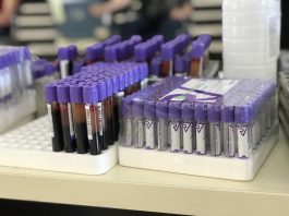 Slab odaziv dobrovoljnih davalaca krvi