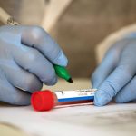 U Novom Pazaru potvrđeno 17 novih slučajeva