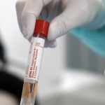 U Sjenici 5 novozaraženih, u Prijepolju 13