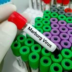 U Gvineji otkriven visokozarazni i vrlo opasni virus Marburg