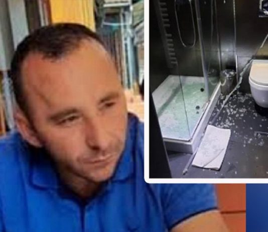 Staklo tuš kabine isjeklo Tutinca: “Vlasnik hotela me nije pozvao ni da pita kako sam”