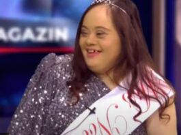 Miss Novog Pazara: Daunov sindrom je ne sprječava da ljepotu pokaze i u Istanbulu