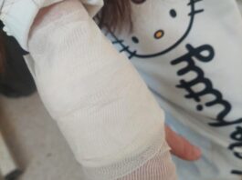 PSI LUTALICE IZUJEDALI DJEVOJČICU U NOVOM PAZARU: Ima ozbiljne povrede po rukama, nogama i glavi