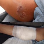 Još jedan napad psa na dijete u Novom Pazaru, od azila još uvek ništa (VIDEO)